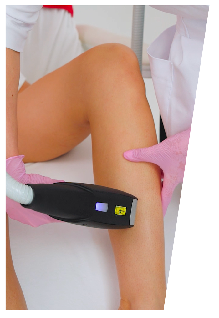 Wszechstronny laser diodowy, który pozwala na szybką, skuteczną i bezpieczną redukcję owłosienia, zapewniając trwałe efekty już po serii zabiegów.